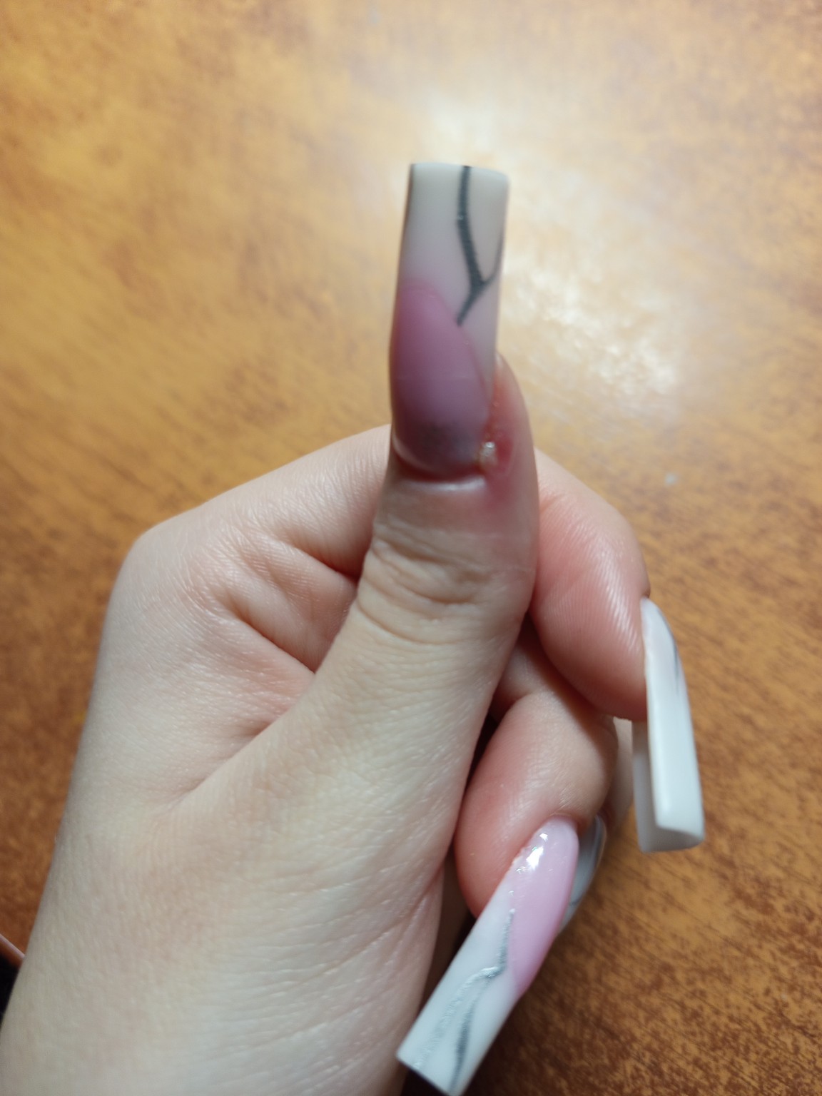 Изображение задачи: Что это ? Реши задачу: Что делать болит ? Реши зад