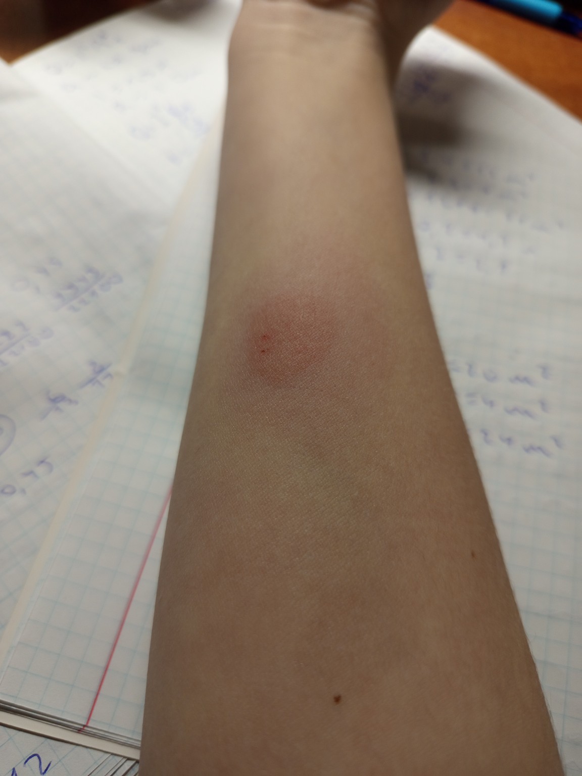 Изображение задачи: Нормально или нет ? ( это монта )