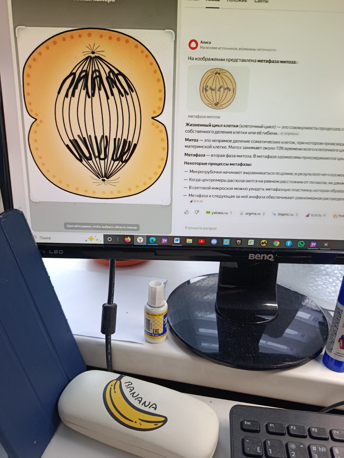 Изображение задачи: Разве не метафаза?