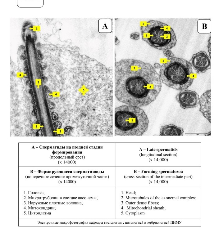 Изображение задачи: Подробные объясните