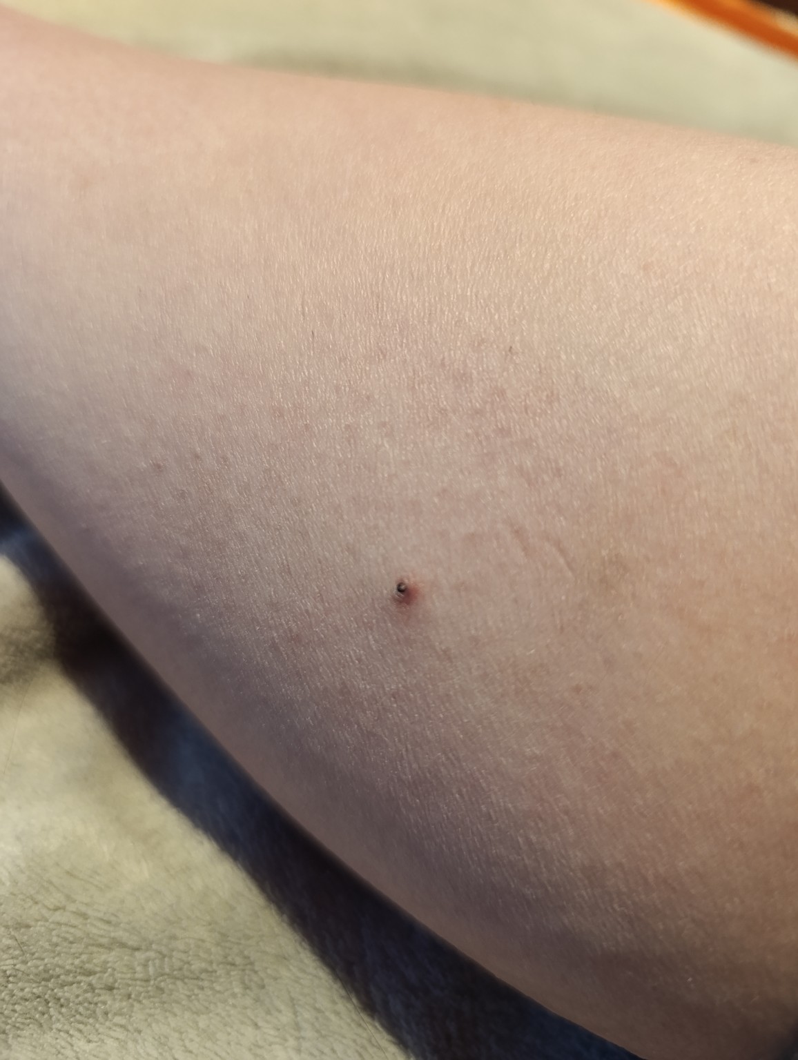 Изображение задачи: Реши задачу: Что это у меня на ноге? Реши задачу: 