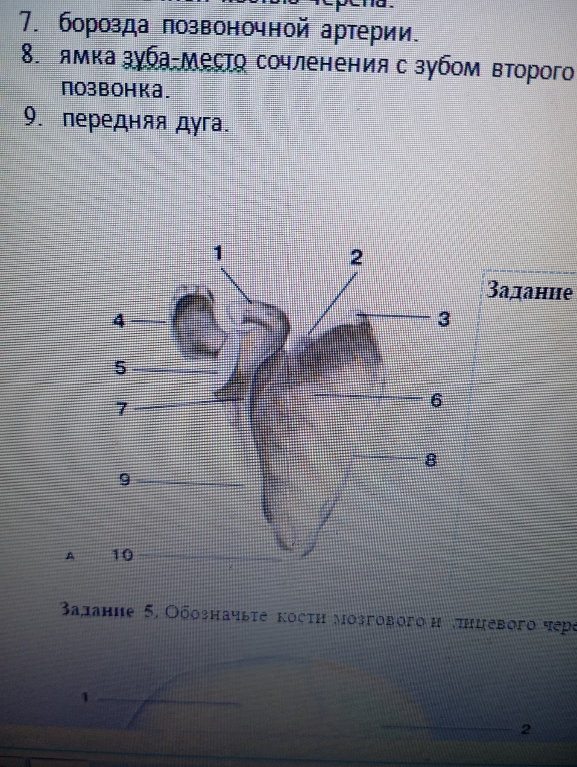 Изображение задачи: Реши задачу: Название позвонка и его элименты Реши