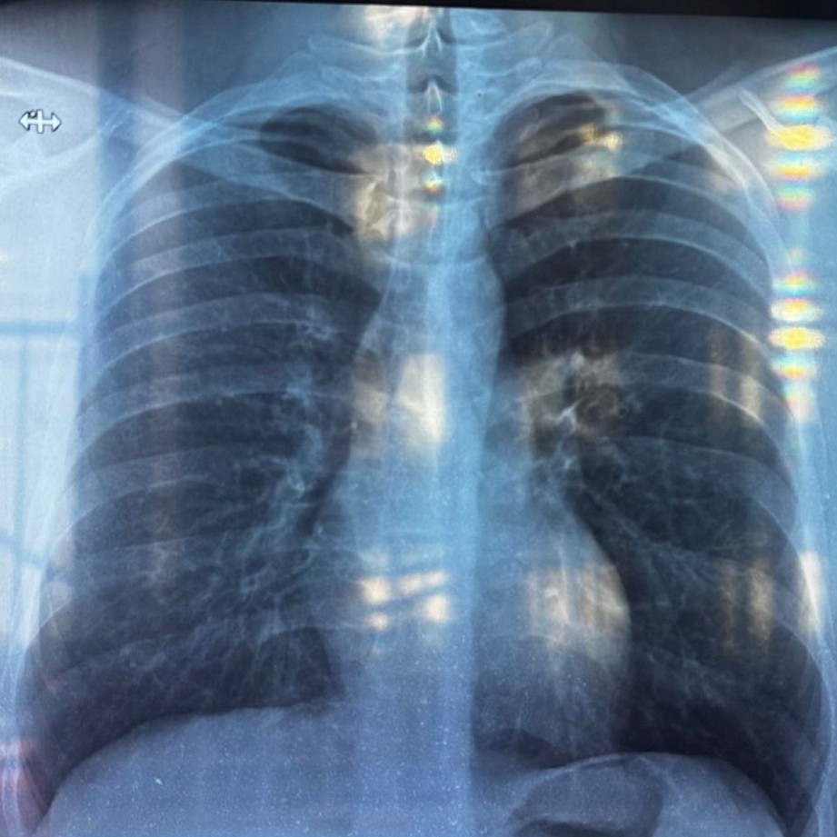 Изображение задачи: Написать диагноз