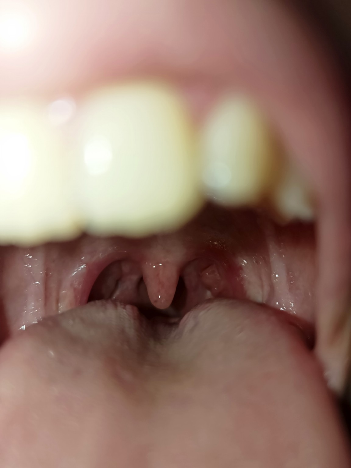 Изображение задачи: Реши задачу: Болит горло. Определи по фото что не 