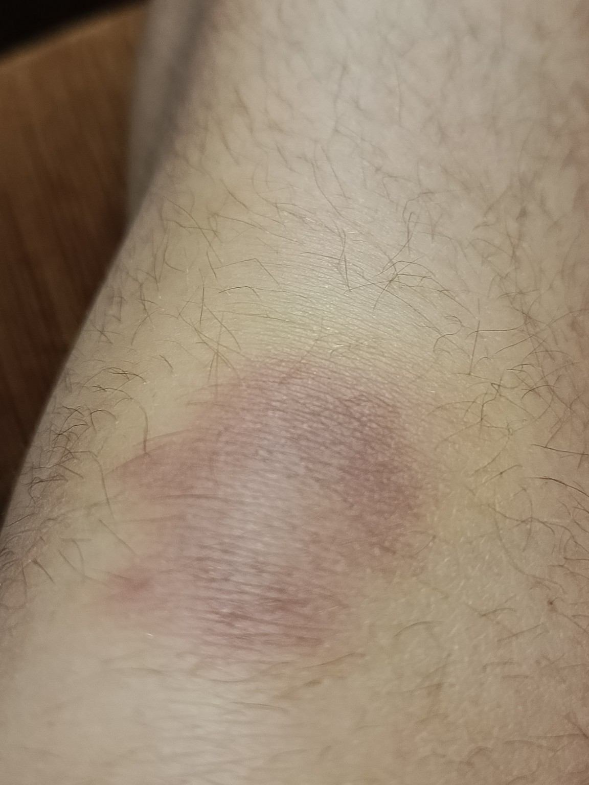 Изображение задачи: Реши задачу: убери волосы на ноге реалистично